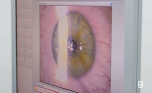 ‘No one has ever done such eye surgeries at once’